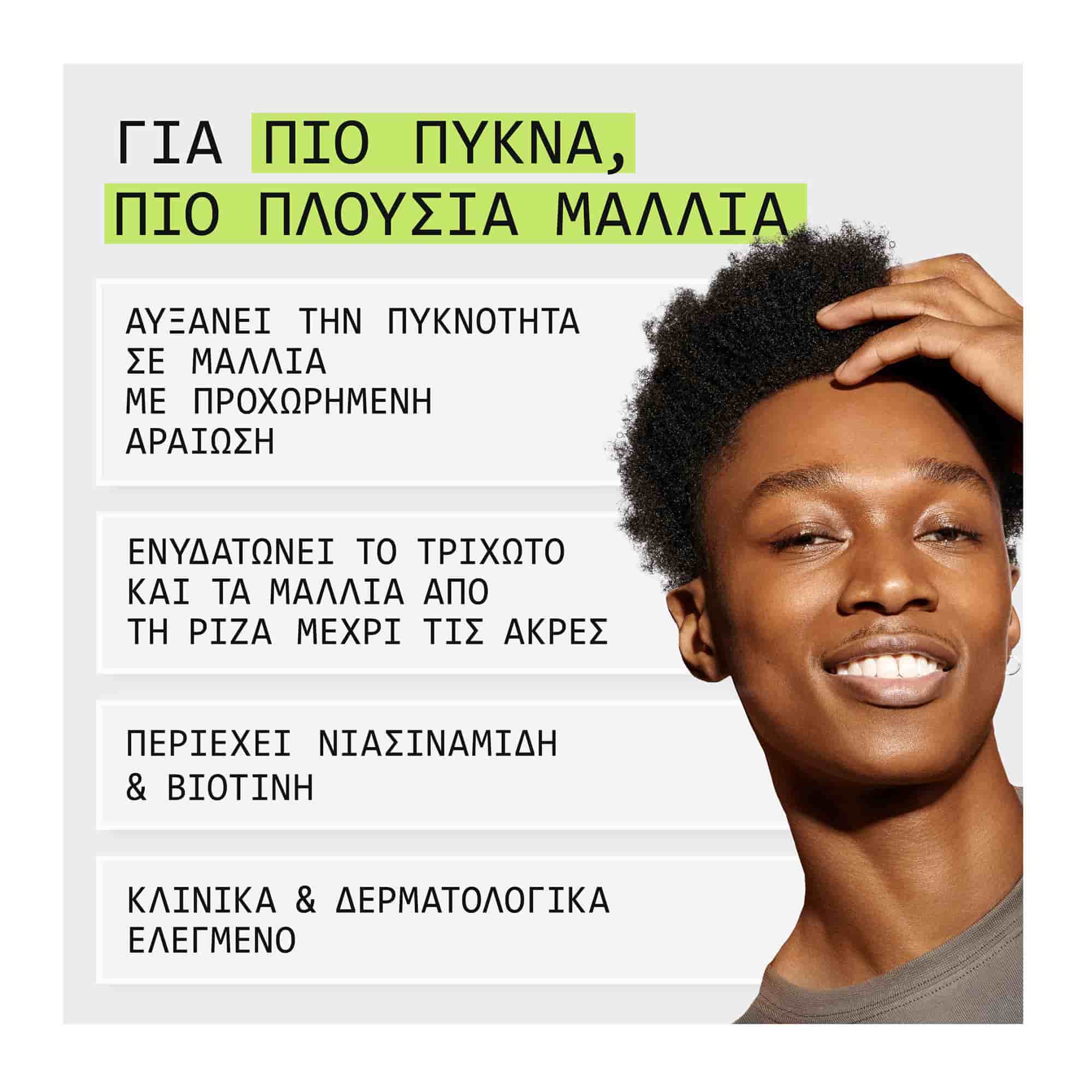 Nioxin Scalp & Hair Σύστημα 2 Σαμπουάν κατά της Τριχόπτωσης για Φυσικά Μαλλιά 300ml