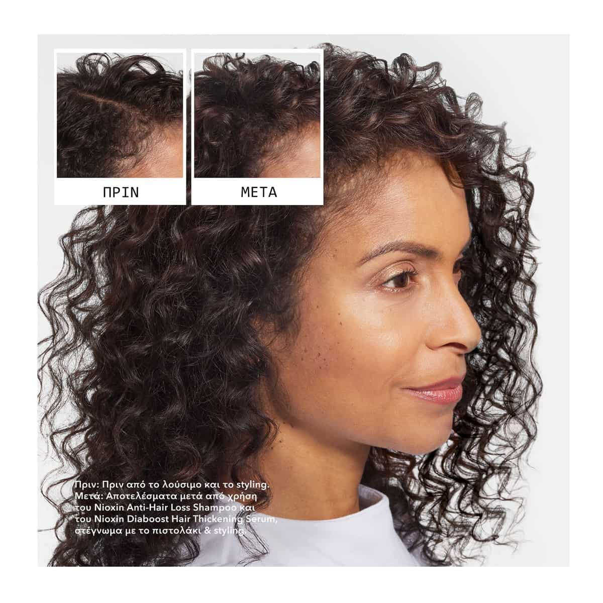 Nioxin Anti-Hair Loss Σαμπουάν κατά της Τριχόπτωσης 475ml