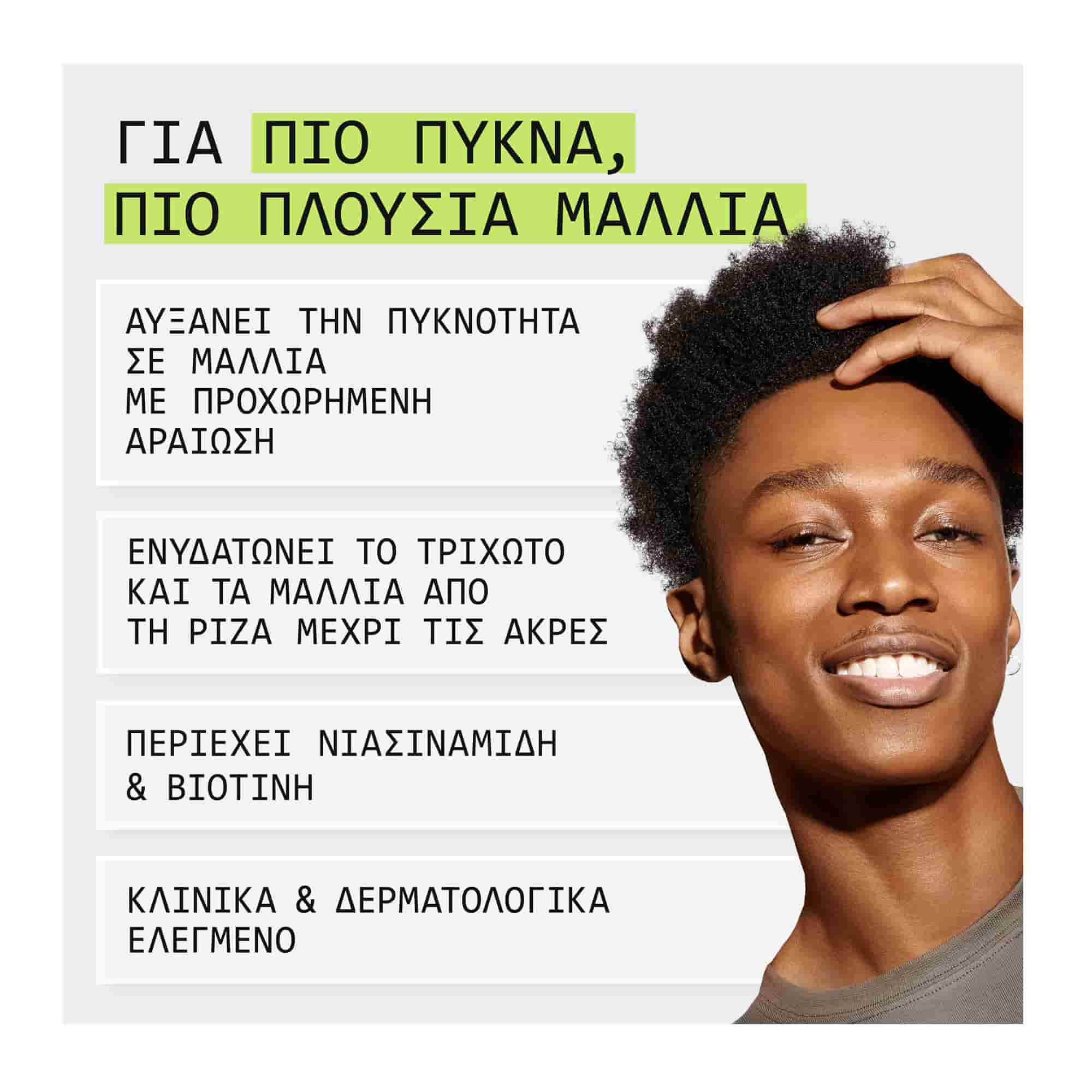 Nioxin Scalp & Hair Σύστημα 2 Conditioner Κατά της Τριχόπτωσης για Λεπτά Φυσικά Μαλλιά με Έντονη Αραίωση 300ml 3